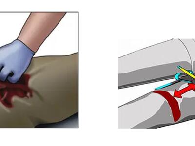 Emergenza emorragie massive: la vita si salva in pochi minuti, M&amp;ta multiservizi lancia il corso C.e.m.e. a Massa.