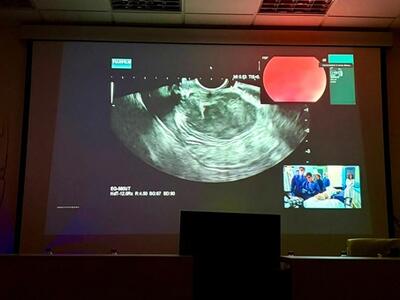 Da tutta Italia all'ospedale Apuane: tre giorni di alta formazione in Gastroenterologia ed Endoscopia con EUS ACADEMY 2026